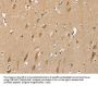 SLC6A7 Antibody