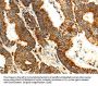 MAP1LC3A Antibody