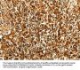 MAP1LC3A Antibody