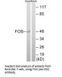 FOS (Ab-232) Antibody