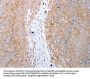 CDK20 Antibody