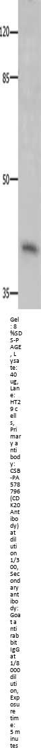 CDK20 Antibody