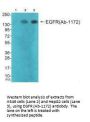 EGFR (Ab-1172) Antibody