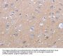 CXCR3 Antibody