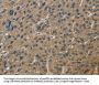 CORO1C Antibody