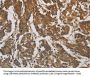 CORO1C Antibody