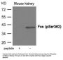 Phospho-FOS (Ser362) Antibody