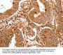 FOXO3 Antibody