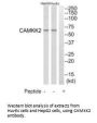 CAMKK2 Antibody