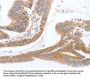 Rabbit anti-human TGFA polyclonal antibody