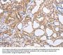 Rabbit anti-human TGFA polyclonal antibody