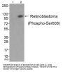 Phospho-RB1 (Ser608) Antibody