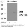 Phospho-NPM1 (Thr199) Antibody