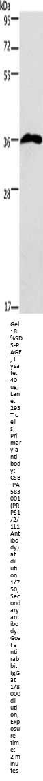 PRPS1/PRPS2/PRPS1L1 Antibody
