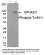 Phospho-EPHA2/EPHA5 (Tyr594) Antibody