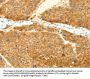 SNAP25 Antibody