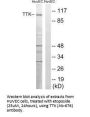 TTK (Ab-676) Antibody