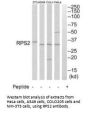 RPS2 Antibody
