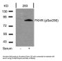 Phospho-FOXO1 (Ser256) Antibody