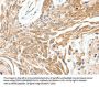 SCN11A Antibody