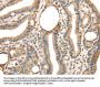 TRIB3 Antibody