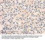 TRIB3 Antibody