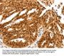 PDCD6 Antibody