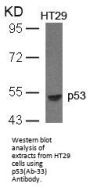 TP53 (Ab-33) Antibody