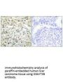 DNMT3B Antibody
