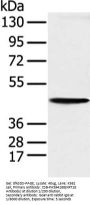 KRT18 Antibody
