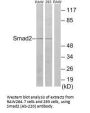SMAD2 (Ab-220) Antibody