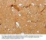 SLC2A5 Antibody