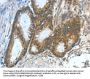ASNS Antibody