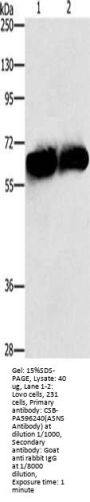 ASNS Antibody