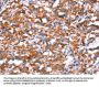 GH1 Antibody