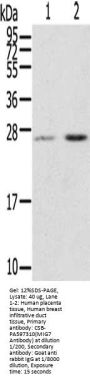 MIG7 Antibody