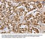 HNRNPL Antibody