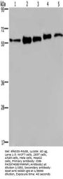 HNRNPL Antibody