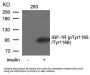 Phospho-IGF1R (Tyr1165/Tyr1166) Antibody