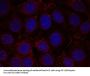 Phospho-IGF1R (Tyr1165/Tyr1166) Antibody