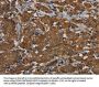 PIK3CD Antibody