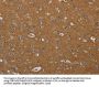 PIK3CD Antibody