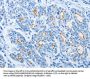 NEK10 Antibody