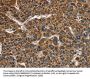 CAT Antibody