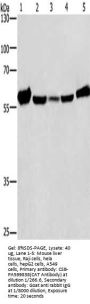 CAT Antibody