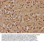 RBL2 Antibody