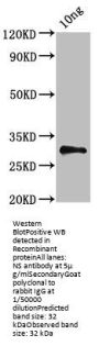 NS Antibody