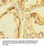 INCA1 Antibody
