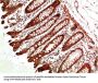ATM Antibody
