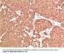 ATM Antibody